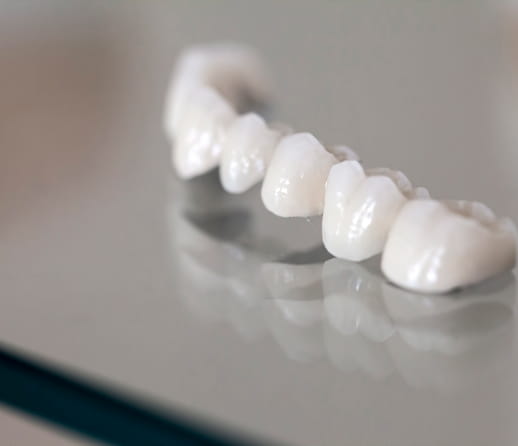 オールセラミック